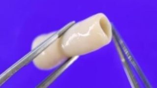 サイフューズの細胞製人工血管