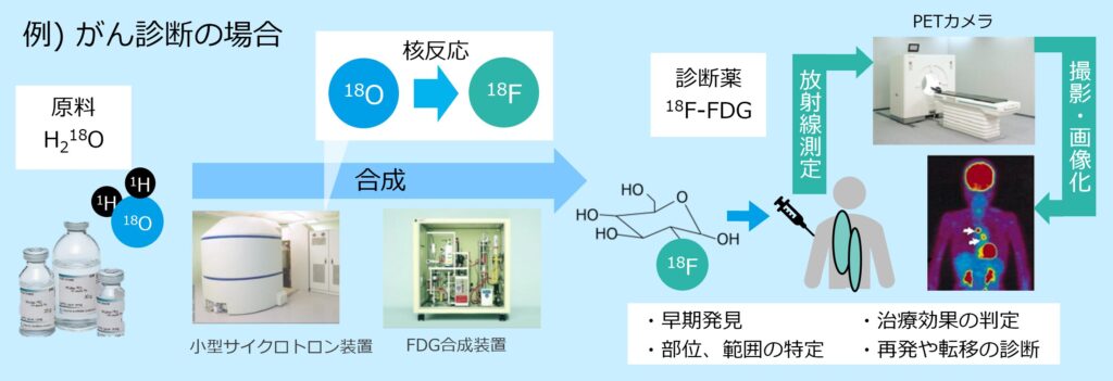 「Water-18O」を使用したPETによるがん診断